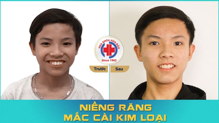 Hình ảnh 2 của Nha Khoa Hân Đào Thái Bình