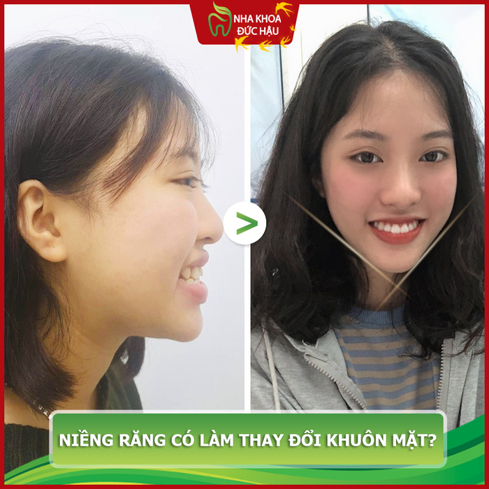 Hình ảnh 1 của NHA KHOA ĐỨC HẬU