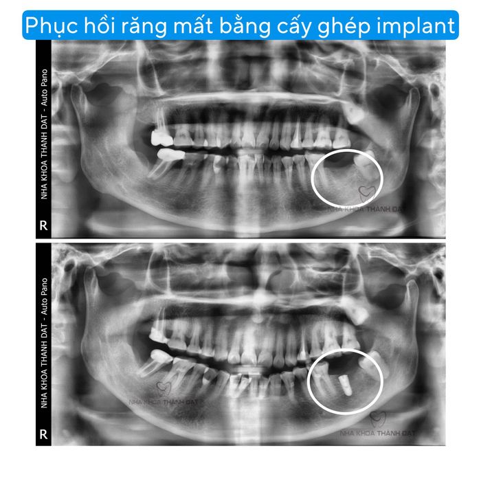 Hình ảnh 1 của Nha Khoa Thành Đạt