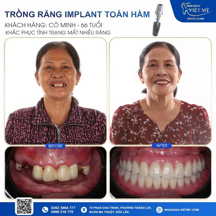 Hình ảnh 1 của Nha khoa Việt - Mỹ chi nhánh Đắk Lắk