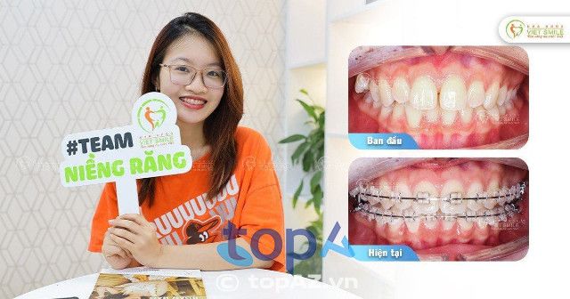 Nha khoa VIET SMILE, quận 10, TP. HCM