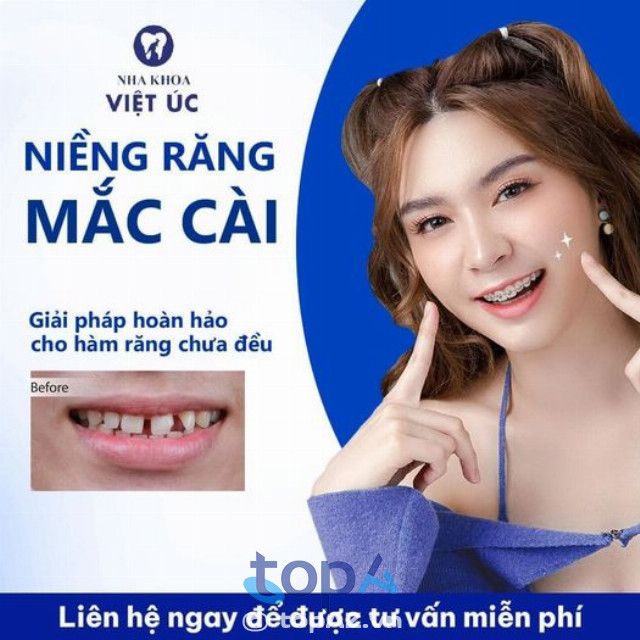 địa chỉ niềng răng trả góp đáng tin cậy nhất tại Huế