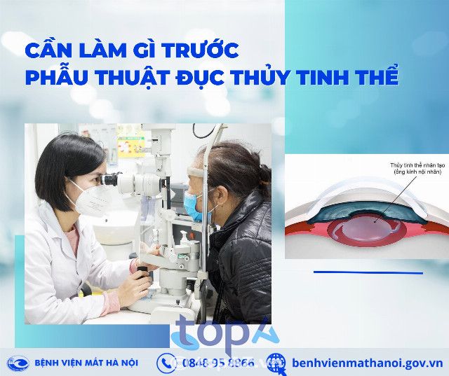 Các bệnh viện mắt tại Hà Nội