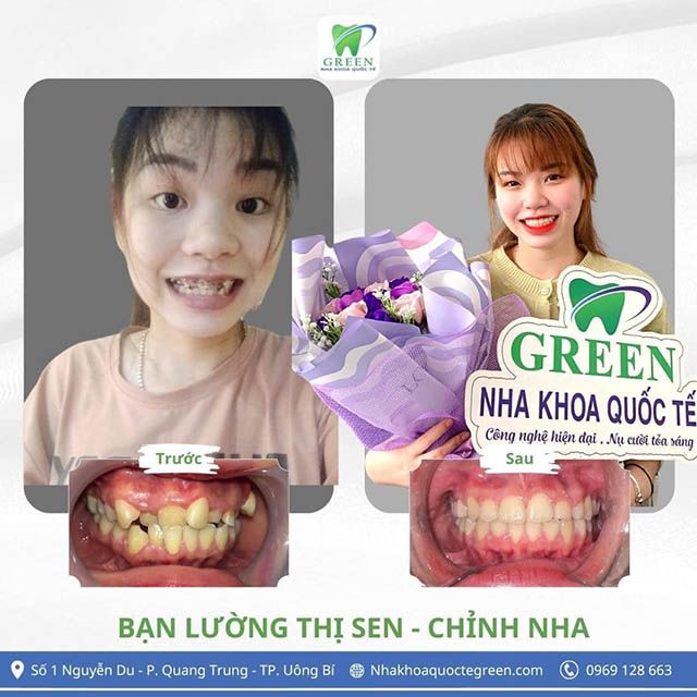 Nha khoa quốc tế Green