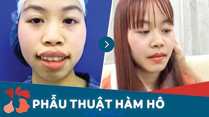 Bệnh viện Thẩm mỹ Kang Nam