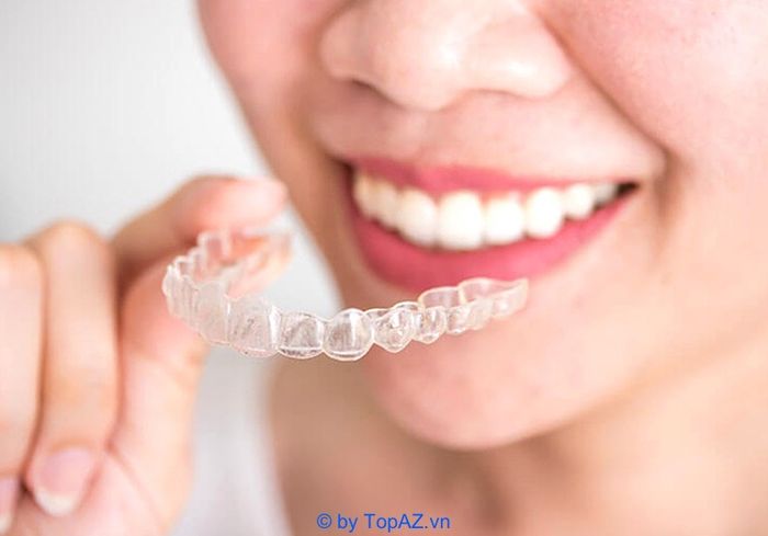 Các địa chỉ niềng răng Invisalign uy tín tại Hà Nội