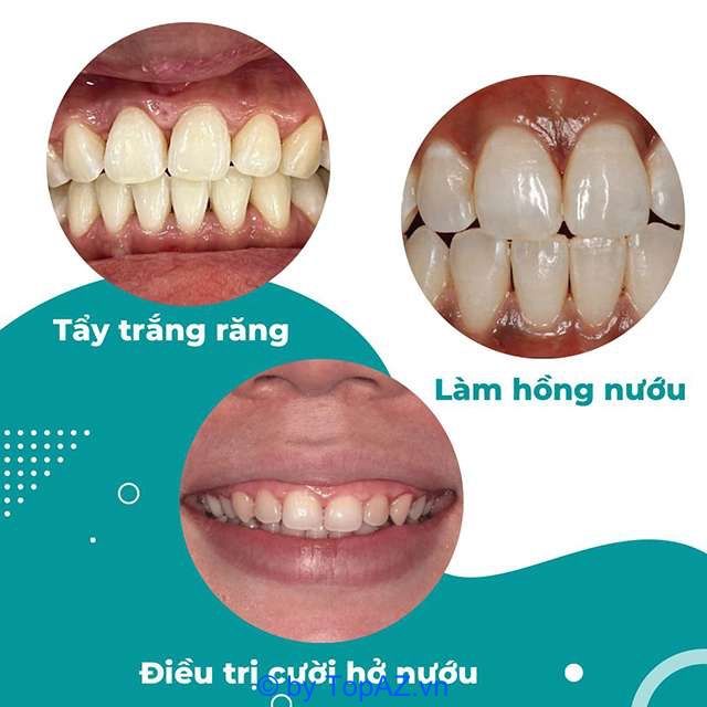Phòng khám nha khoa chất lượng tại quận 8