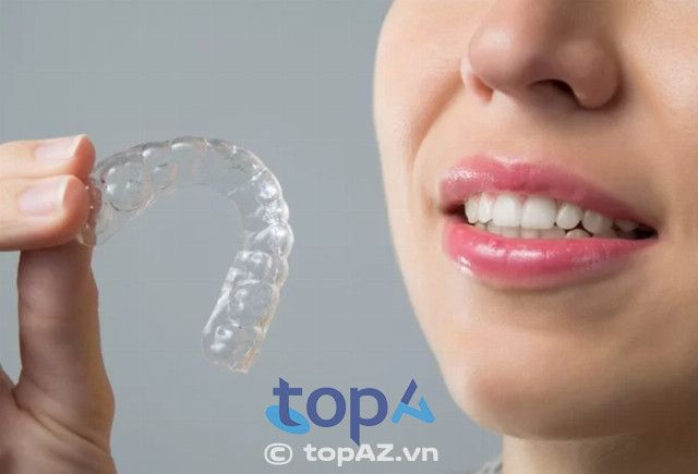 Niềng răng trong suốt tại Nha khoa Kim ở TPHCM