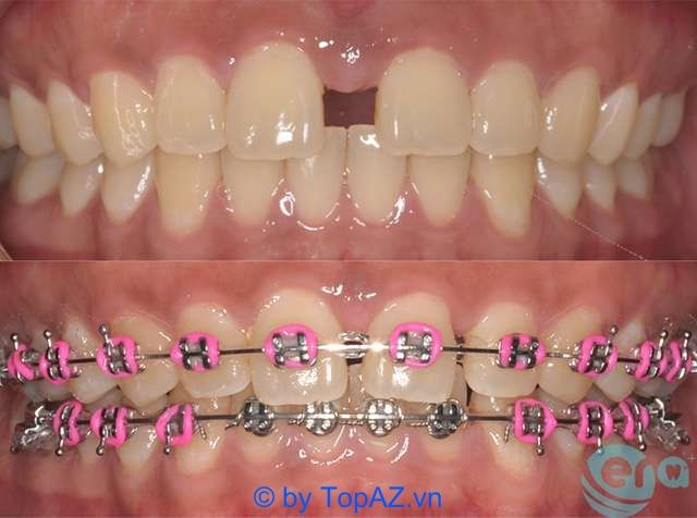 phòng khám nha khoa đáng tin cậy tại quận 8