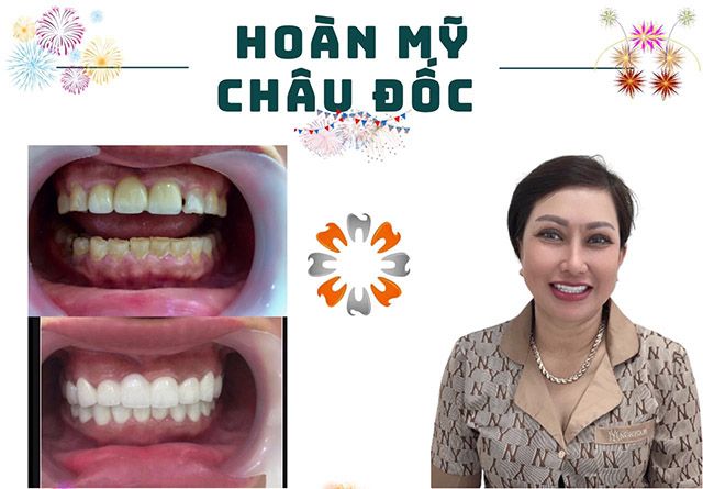 Phòng khám nha khoa Hoàn Mỹ Sài Gòn tại Châu Đốc, An Giang