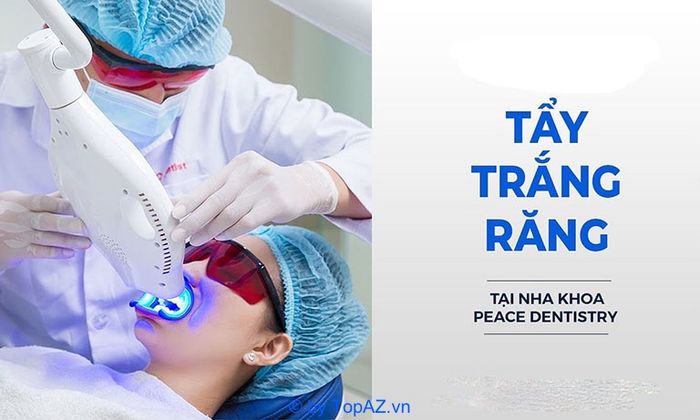 Tẩy trắng răng ở đâu tốt tại TP.HCM