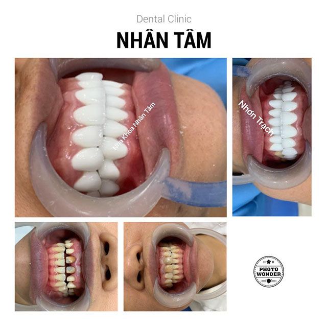 Phòng khám Nha Khoa Nhân Tâm tại Nhơn Trạch, Đồng Nai