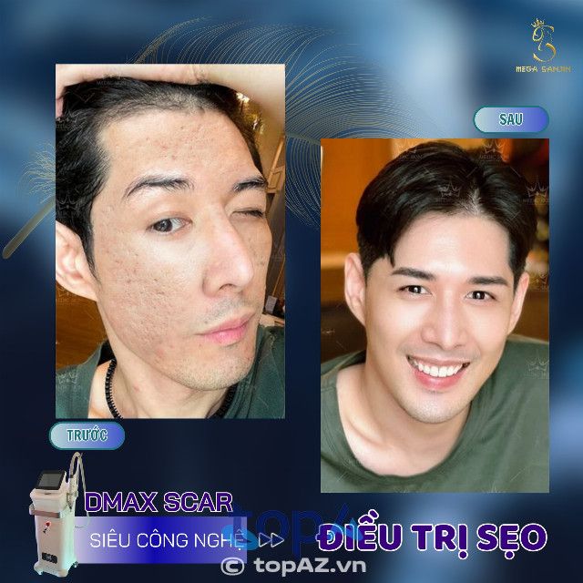 Thẩm Mỹ Mega SanJin tại Cần Thơ