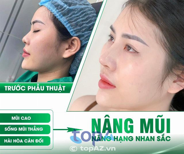 Phòng khám Chuyên khoa Phẫu thuật Thẩm mỹ Hường Xô tại Nghệ An