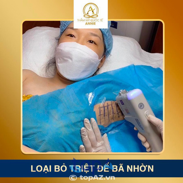 spa triệt lông tại Thủ Đức đánh giá