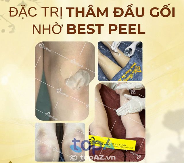 Mai Beauty Spa and Clinic tại TPHCM