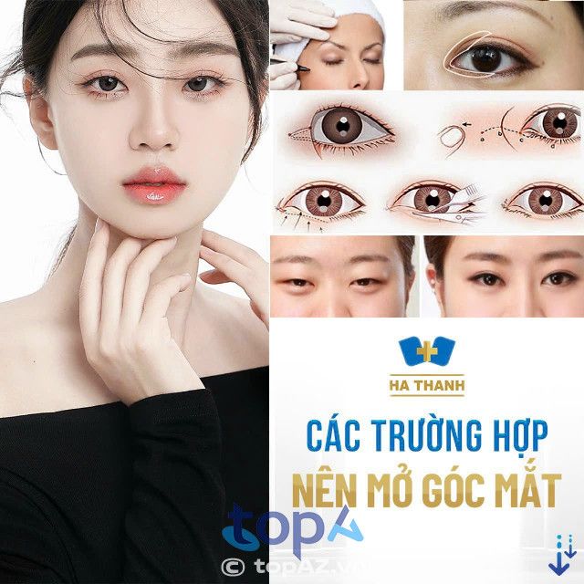 địa chỉ sửa mí mắt hỏng hàng đầu ở Hà Nội