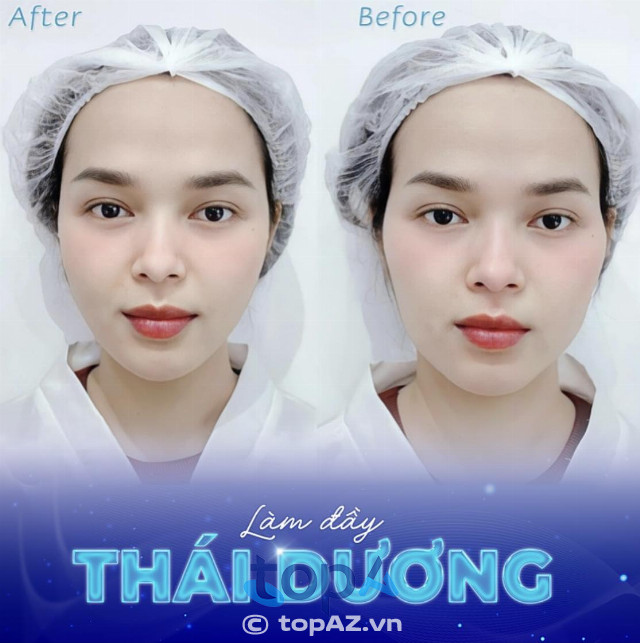 địa chỉ tiêm filler an toàn tại Đà Nẵng