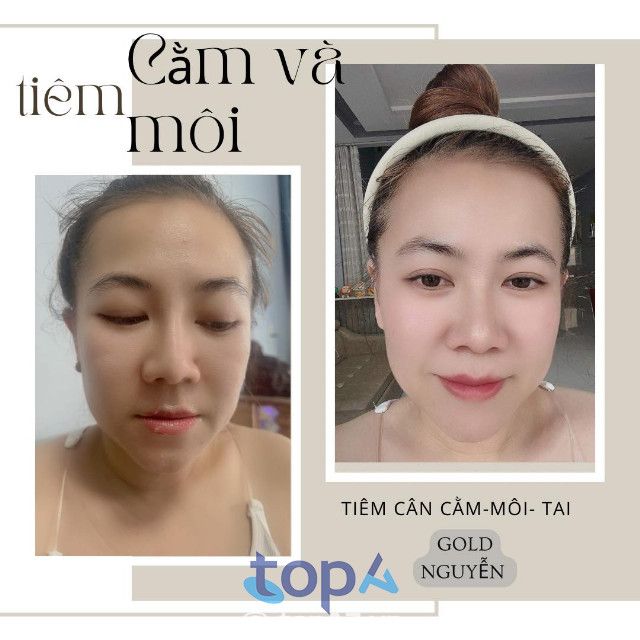 Spa làm đẹp nào tốt tại Tp Tuy Hòa