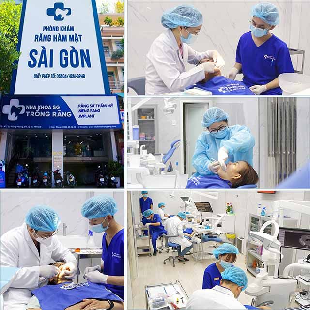 Phòng khám nha khoa trồng răng Sài Gòn uy tín