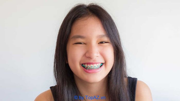Các địa chỉ niềng răng chất lượng tại Hà Nội