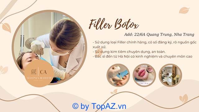 tiêm filler tại Nha Trang