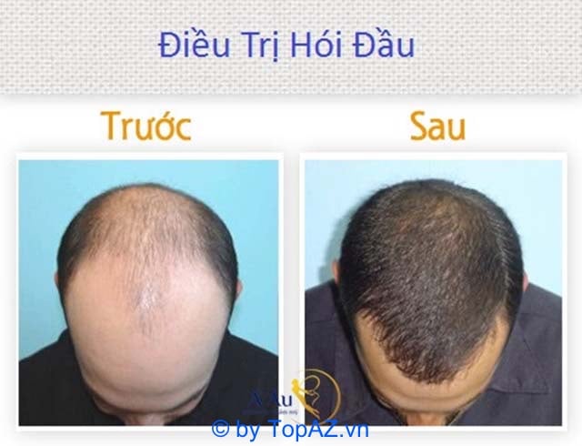 phòng khám trị rụng tóc tại TPHCM