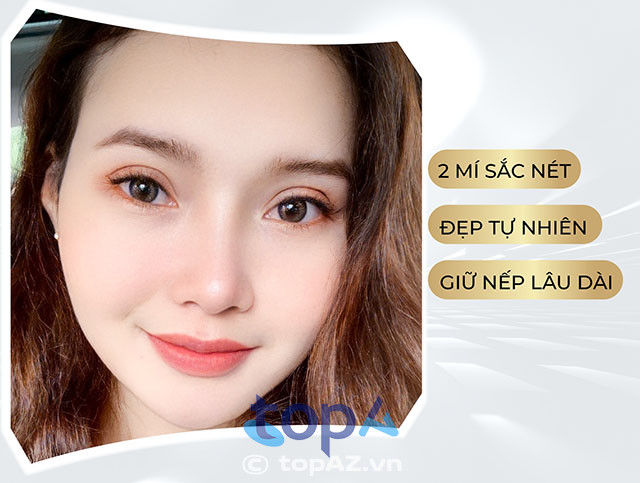 sửa mí mắt tphcm