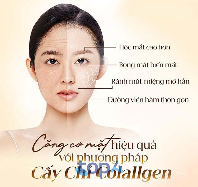 Địa chỉ căng da mặt tại TP Mỹ Tho