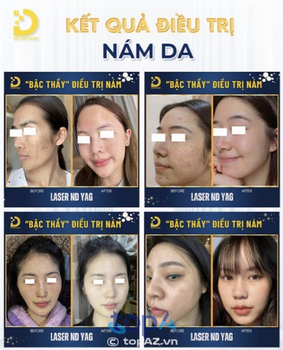 Dr. Choice Clinic – Địa chỉ uy tín điều trị nám và tàn nhang tại TP. HCM