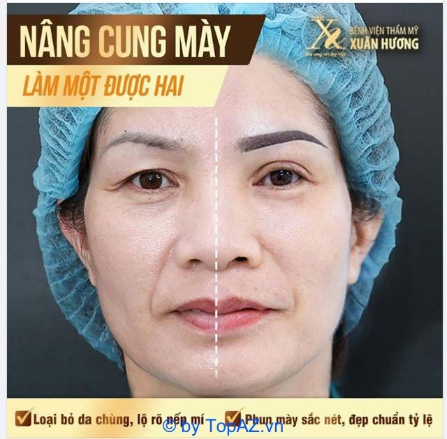 nâng cung chân mày hà nội