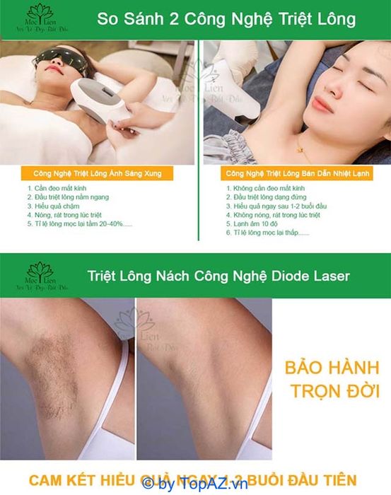 Triệt lông uy tín tại TP. HCM với thẩm mỹ Mộc Ý Liên, Quận 10