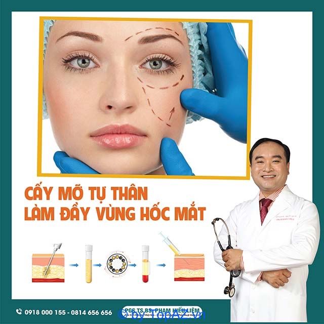 cấy mỡ hốc mắt TPHCM