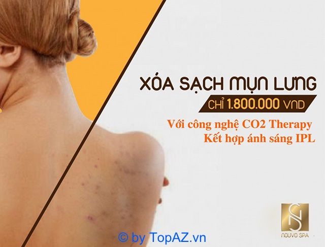 spa trị mụn lưng tại TPHCM