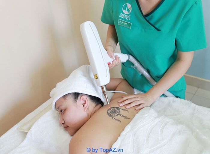 Xóa hình xăm ở đâu tại TPHCM?