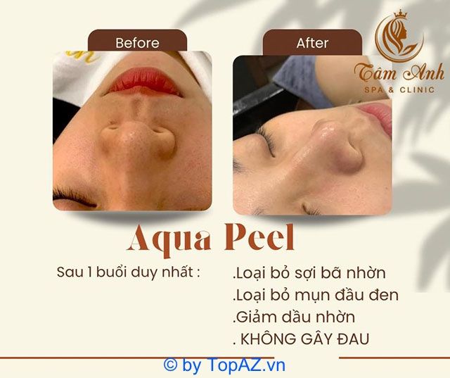 Spa làm đẹp uy tín và chuyên nghiệp tại Thanh Hóa