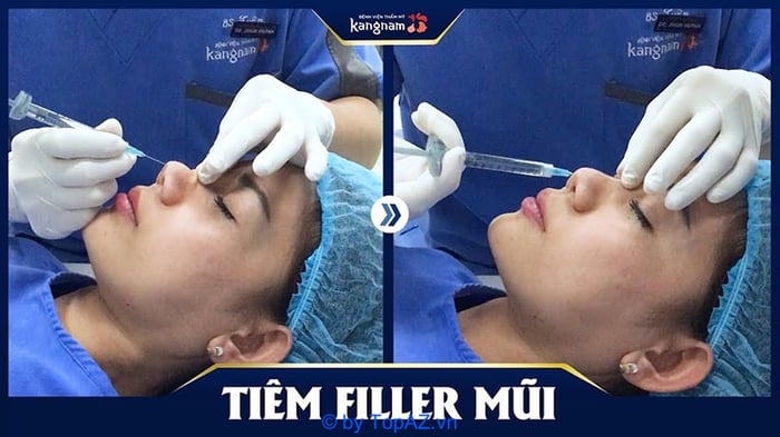 Nơi tiêm filler an toàn tại Hà Nội