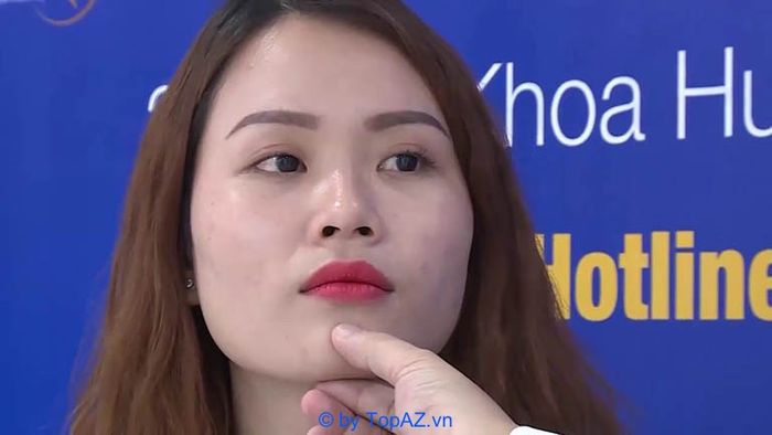 địa chỉ độn cằm uy tín tại TPHCM