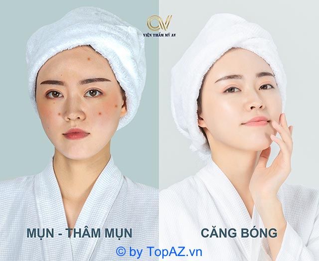 spa đà nẵng giá rẻ