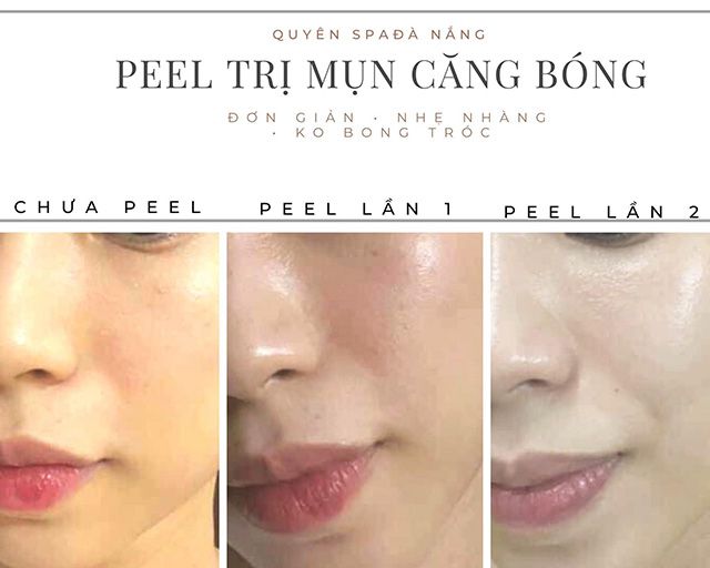 Danh sách các spa trị mụn và làm đẹp tại Quận Sơn Trà, Đà Nẵng