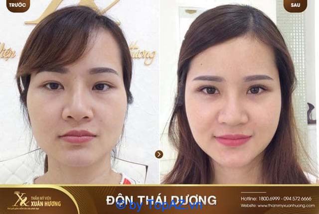 Độn thái dương đẹp ở đâu tại TPHCM