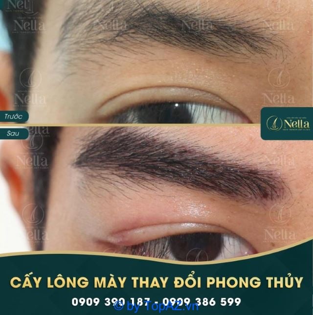 địa chỉ cấy lông mày tại TPHCM