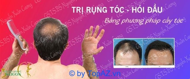 địa chỉ cấy tóc uy tín tại TPHCM