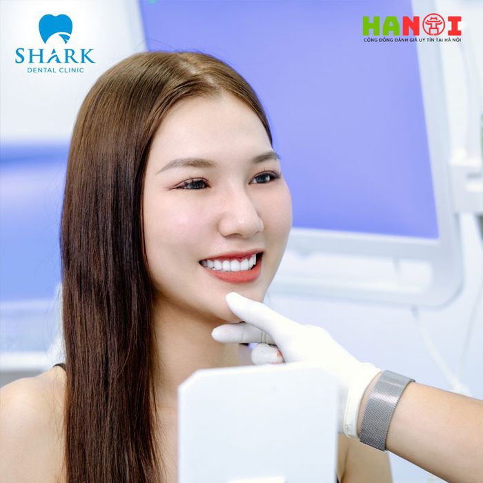 bang-gia-cay-ghep-rang-implant-tai-nha-khoa-shark-Mytour