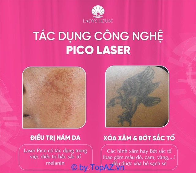 Dịch vụ điều trị nám da tại Lady’s House Spa Bình Dương