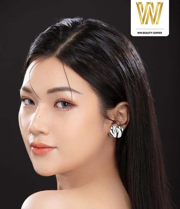 Thẩm mỹ Quốc tế Win tiêm filler