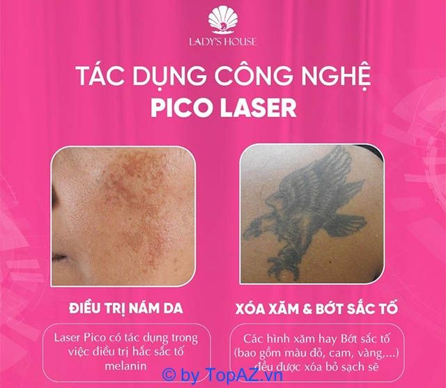 Dịch vụ xóa xăm laser tại Lady’s House Spa Bình Dương