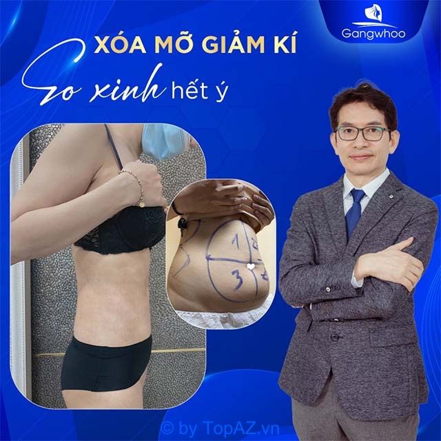 Xóa mỡ giảm cân tại Thẩm mỹ viện Gangwhoo