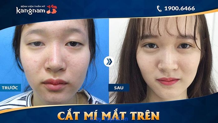 Bệnh viện thẩm mỹ Kangnam có uy tín không, có gây lừa đảo khách hàng không?