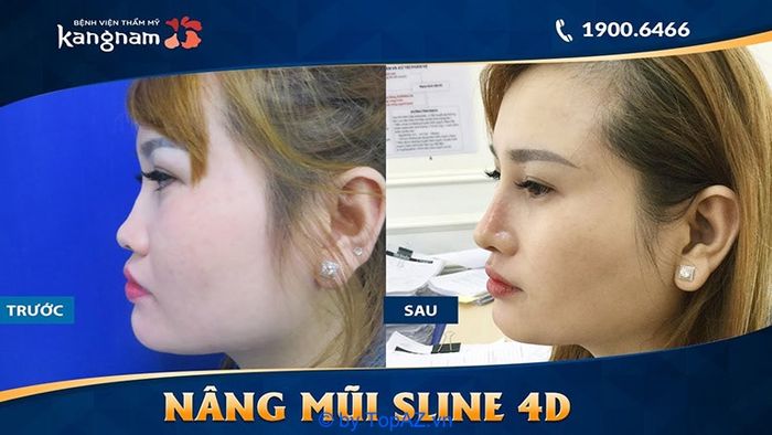 Bệnh viện thẩm mỹ Kangnam có uy tín không, có gặp vấn đề lừa đảo không?